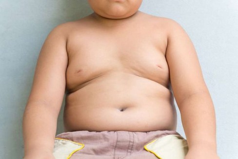 Ieri l'Obesity day. <span>Foto Scienza e Salute</span>