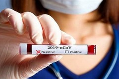 Finito lo stato di emergenza per il Covid