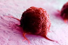 Metastasi: nuovi studi rivelano meccanismi di diffusione finora sconosciuti