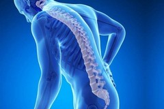 Da Pennetti Lab una giornata dedicata alla prevenzione dell'osteoporosi