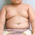 “Cibiamoci” per l’Obesity Day