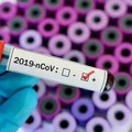 Bollettino Covid, in Puglia registrati altri 239 positivi e due decessi