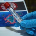 13.1% di test positivi nelle ultime ore sul territorio regionale