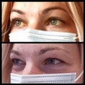 La sindrome da bilirubina pronta per essere curata