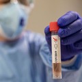 Coronavirus, altri dieci positivi in Puglia. Ieri due decessi