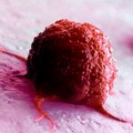 Metastasi: nuovi studi rivelano meccanismi di diffusione finora sconosciuti