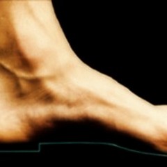 Traumi più comuni del piede dell’atleta (1^ parte)