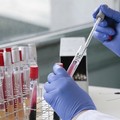 Coronavirus, altri 11 casi anche ieri in Puglia. Nessun decesso nell'ex provincia barese