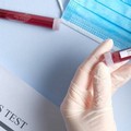 Sesto caso accertato di Coronavirus in Puglia