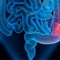Tumore del Colon retto: un enzima "l’osservato speciale"