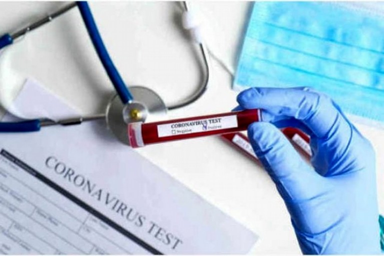 Coronavirus test
