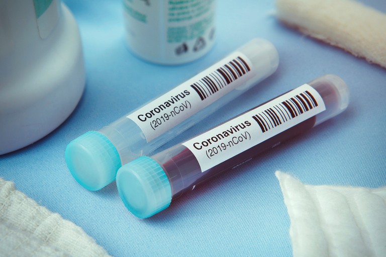 Coronavirus test