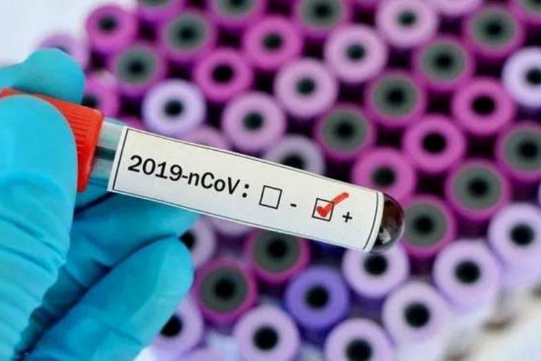 Coronavirus test