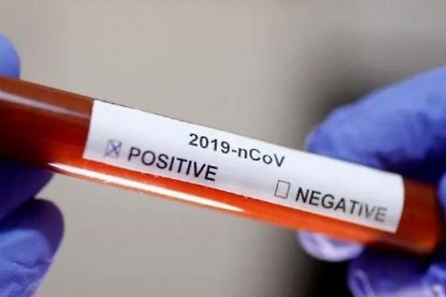 Coronavirus test