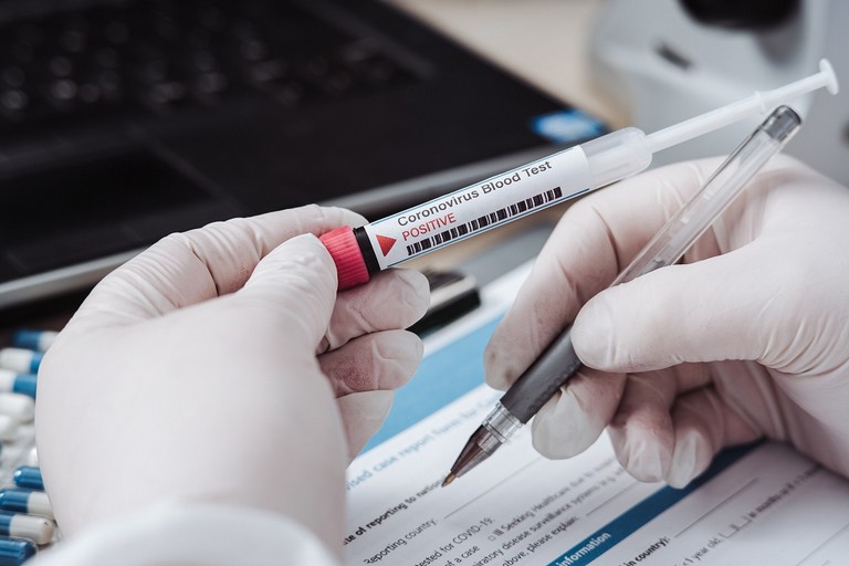 Coronavirus test
