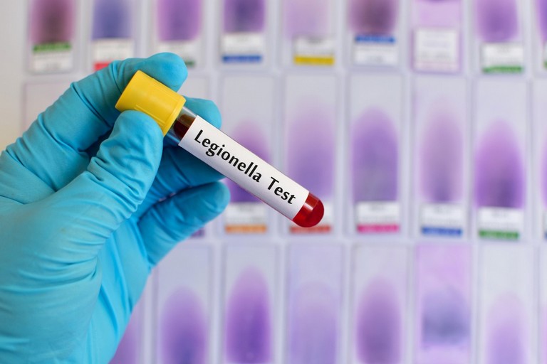 Legionella, la campagna di prevenzione ASL Bari