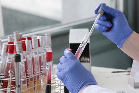 Coronavirus- test
