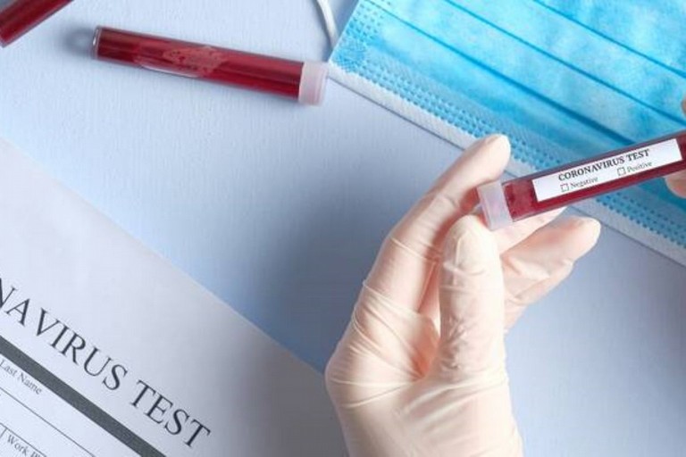 Test Coronavirus