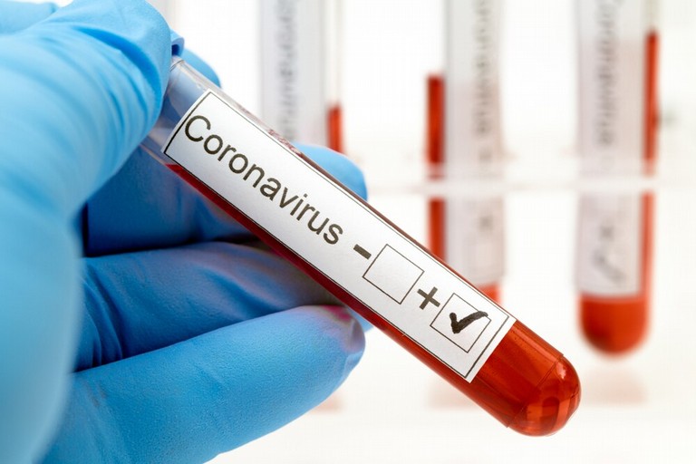 Coronavirus test